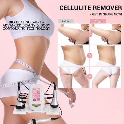 Ultrasonic Cavitation Slimming Machine