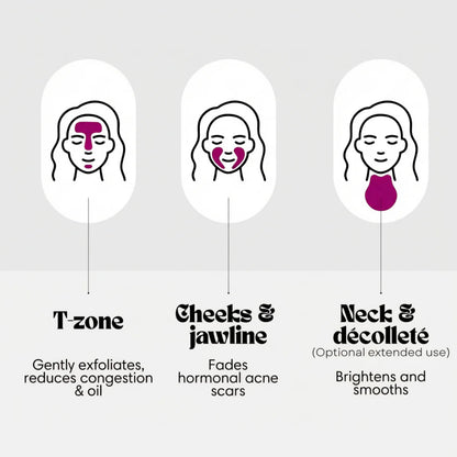 Arbutin 7% + Tranexamic Acid 4% Cream