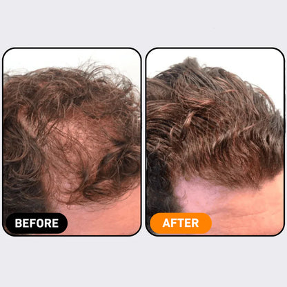 Root Activating Shampoo